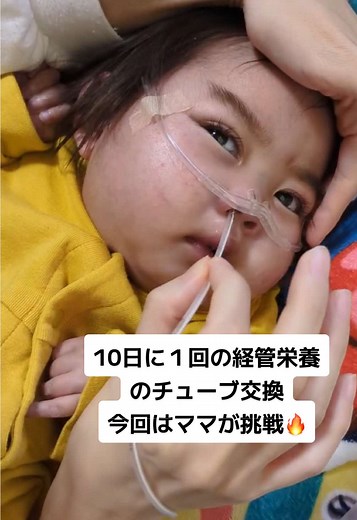 経管栄養チューブ交換の挑戦と成長