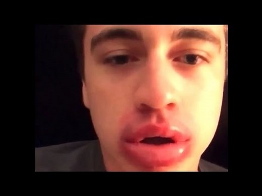 Kylie Jenner Lip Challenge Fails