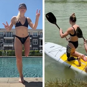 18K views · 213 reactions | Daily Adulting with Bionic Leg | Lady Panda | Facebook