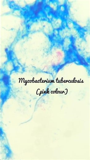 Tuberculosis (TB) causing bacteria Mycobacterium tuberculosis under microscope 🔬#biology #science
