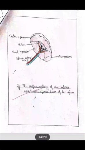 assignment on lymphatic system. #assignment #nursing #1st sem assignment #anatomy