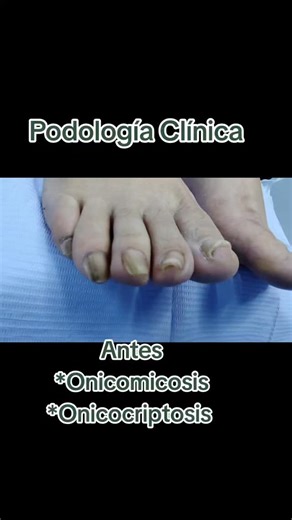PodologiaSteticaMagie on Instagram: "👣 PODOLOGÍA CLINICA 👣 Al cuidado de sus pies!!! ❗ Usamos la máquina de Ozono + gotas antimicoticas ❗ 👣 Servicio de podología a domicilio 📌 Profilaxis 📌 Extracción de uñas encarnadas 📌 Reconstrucción de uñas 📌 Podología geriátrica 📌 Podología pediatrica 📌 Tratamiento para uñas con onicomicosis 📌Ventas de productos antimicóticos y otros 🔹 Atención a paciente diabético ( previa evaluación) ESCRIBENOS AL WHATSAPP 974942629 💵 MÉTODOS DE PAGO 💵 ♥️ Tarj