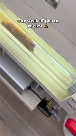 Every week we see over 100 clients to help them with their gut issues, bloating, constipation, autoimmune conditions, skin, hormones …. You name it! What most people don’t realise is how much the toxic load in our body is affecting all aspects of health. When our colon and liver is burdened by overly processed foods, alcohol, vaping and stress and environmental toxins our whole health is affected. Colonics tell the story of what is going on in your body and everyone’s poo matches what they are g