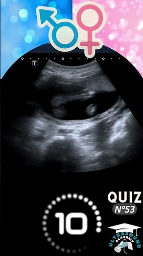 Ultrasound Quiz-53: Can You Guess? Boy or Girl? | Quiz-53 | #ultrasound #babygenderprediction