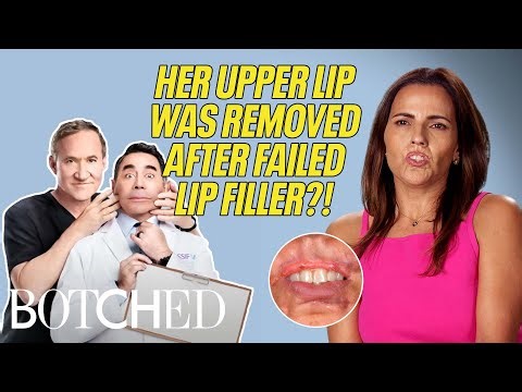 Monica REMOVED Her Upper Lip After Infected Lip Injections?! (Before & After) | Botched | E!