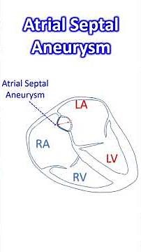Atrial Septal Aneurysm
