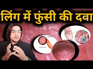 लिंग में फुंसी की दवा।। Infaction of penis।। Penis me infaction।। penis me phunsi