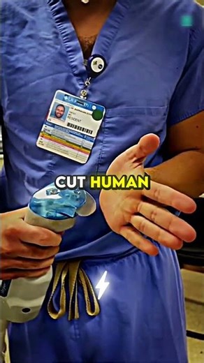 This Is What Happens If A Plaster Cutter Accidentally Runs Over Your Hand 🤯