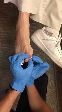 Pimple on a toe? Nope, it's Gout Tophi!