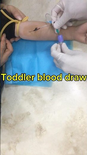 Toddler blood draw #phlebotomy#blutentnahme #coletadesangue #採血