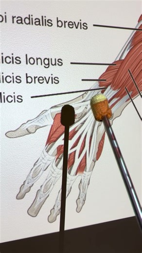 Extensor Digitorum #kinesiology #anatomy #anatomystudy #biomechanics