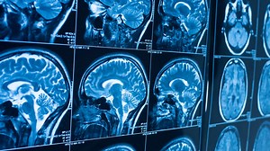 What is CTE and how does football increase the risk?