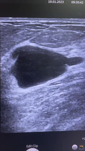 Understanding Fetal Development Through Ultrasound Images