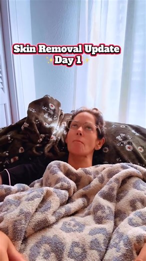 586K views · 13K reactions | POST OP DAY 1 - I love y’all so much!...