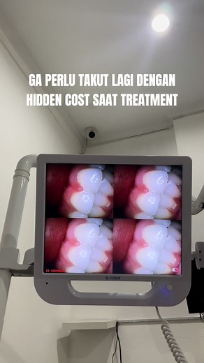 Treatment gigi di Klinik Orange Dental bener2 murah dan harganya transparan, ga ada hidden cost yg bikin treatmentnya jadi mahal!😝💯 #fyp #treatment #scaling #bleach #klinik #klinikgigi