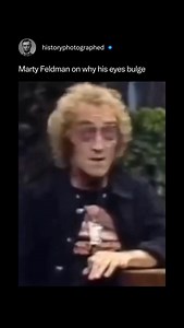 History Photographed on Instagram: "Marty Feldman's distinctively bulging and misaligned eyes were caused by Graves' disease and past injuries, a unique look he fully embraced as his comedic trademark. ⁠ ⁠ He famously joked that his unusual appearance made him a novelty that guaranteed him roles, most notably as Igor in Young Frankenstein, rather than just another conventional actor.⁠ ⁠ Credit: Carson Entertainment Group"