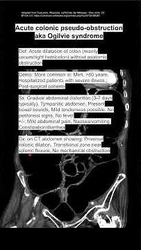Acute colonic pseudo-obstruction aka Ogilvie syndrome