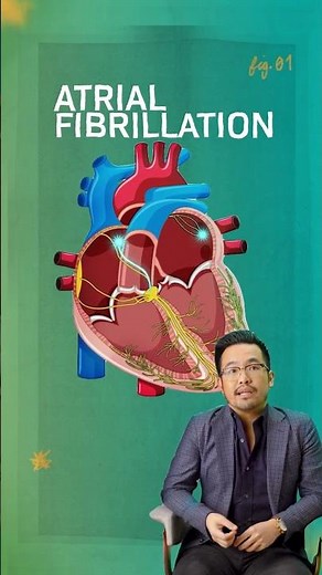 The Hidden Connection Between AFib and Atrial Flutter REVEALED