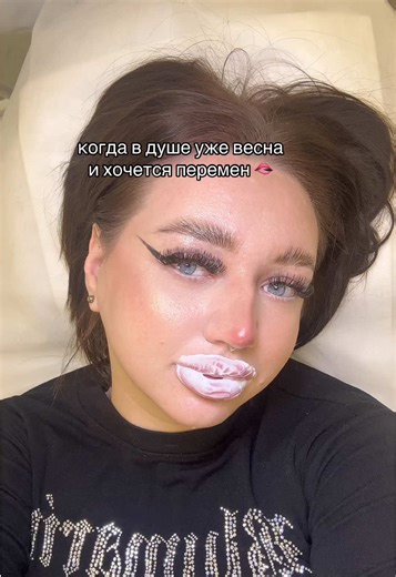 Увеличение губ: Рекомендации от топ косметолога