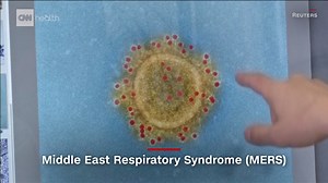 A new Chinese coronavirus, a cousin of the SARS virus, has infected hundreds since the outbreak began in Wuhan, China, in December. Here's what you need to know. https://cnn.it/2RoOJez | CNN International