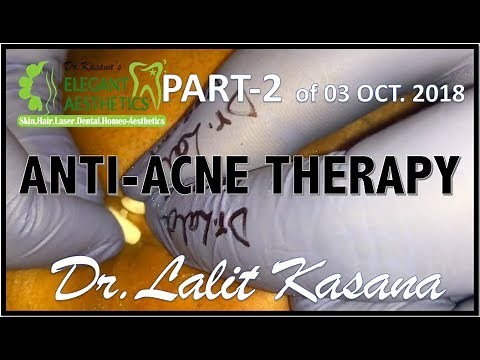ANTI ACNE BLACKHEAD REMOVAL PART-2(3 Oct. 2018) by Dr.Lalit Kasana