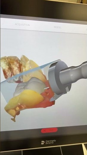 Cerec demonstration (1)