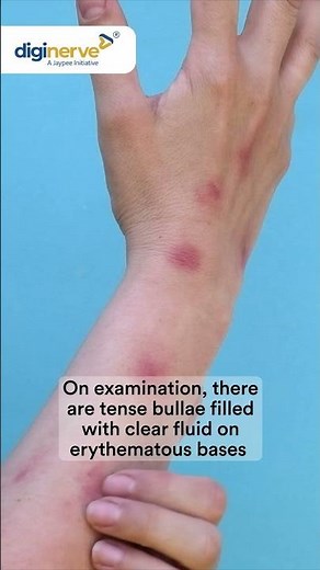 Blisters and Itching in an 86-Year-Old: Can you diagnose this skin condition?