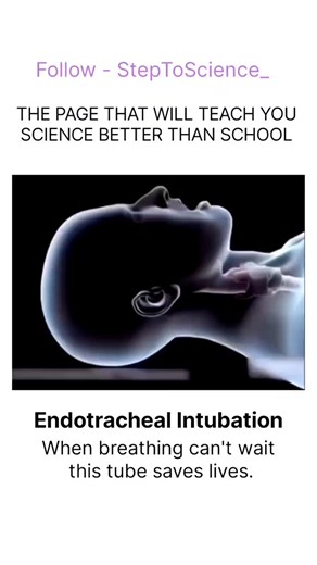 SCIENCE | TECHNOLOGY | UNIVERSE on Instagram: "Endotracheal Intubation 🫁🩺 When breathing can’t wait, this tube saves lives. It keeps the airway open, delivers oxygen directly to the lungs, and supports patients during emergencies, surgery, or critical illness—ensuring every breath counts. 💨❤️ #EndotrachealIntubation #AirwayManagement #EmergencyCare #CriticalCare #LifeSaving #Medical #Healthcare #ICU #Paramedics 🚑"