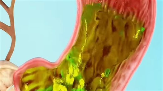 Disgusting simulation shows real reason why your poop smells