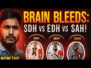 What is Trauma in Brain CT Scans: EDH, SDH, SAH, Contusion?