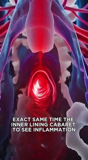 What Does an Asthma Attack Actually Feel Like?