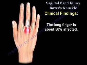 Sagittal Band Injury Boxer's Knuckle