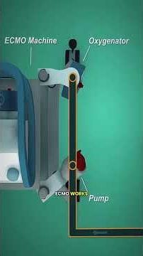 How ECMO Works (3D Animation)