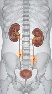 Kidney Stones Formation & Prevention | 3D Anatomy Explained