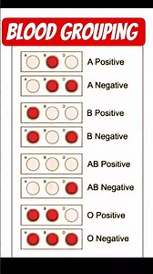 biochemistry youtube channels #biochemistryyoutubechannels #bloodgroup #bloodgrouping #biochem