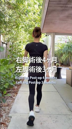 股関節鏡手術後3〜4ヶ月｜今できる動きとリハビリ｜Hip Arthroscopic Surgery Recovery: What I Can Do at 3–4 Months #shorts