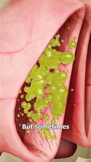 What Happens Inside Your Nose When It’s Blocked? | 3D Animation #shorts