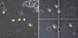 Nosema - Texas Apiary Inspection Service (TAIS)