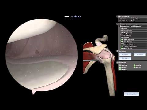 Arthroscopy Training Simulator ArthroS Now With Shoulder Module!
