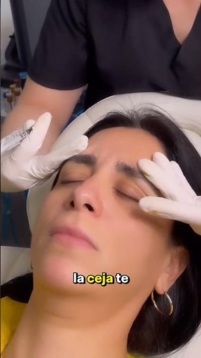 ¿Cuánto tarda el Botox en hacer efecto ? Frente pesada, paralizada, párpado caído #botox