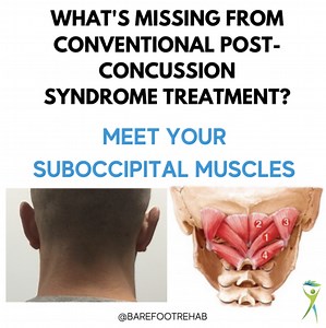 Post Concussion Syndrome Treatment: Got Adhesion in Your Suboccipitals?