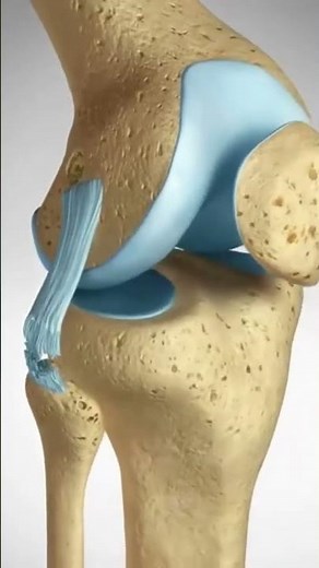See how an ACL LCL Tear is repaired