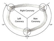 Surgeon Q&A: Aortic Valve Repair Innovations with Dr. Vinay Badhwar