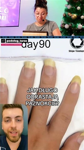 HOW LONG DOES IT TAKE FOR NAILS TO GROW BACK?