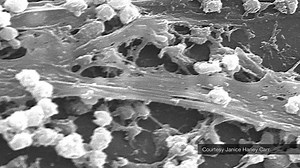 Did you know that MRSA causes nearly 90% of bacterial infections, and these infections result in over 10 million outpatient and emergency room visits and 500,000 hospital admissions per year in the United States? #TomorrowsDiscoveries | Johns Hopkins Medicine