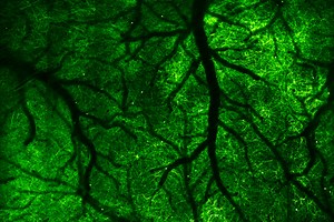 High-speed microscope captures fleeting brain signals - Berkeley News