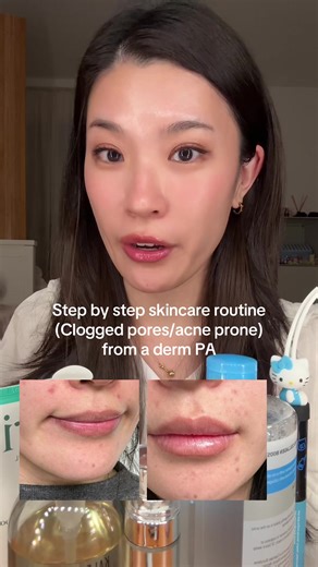 Step-by-Step Skincare Routine for Acne-Prone Skin