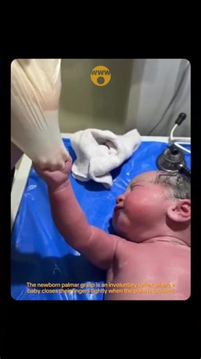 This is a newborn's reflex called palmar grasp