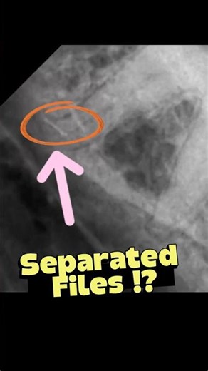 Separated File? What to Do ✅