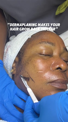 Dermaplaning Myths: The Truth About Hair Growth